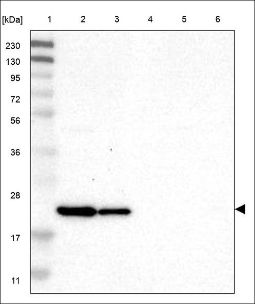 Lane 1: Marker [kDa] 230,130,95,72,56,36,28,17,11 Lane 2: RT4 Lane 3: U-251 MG Lane 4: Human Plasma Lane 5: Liver Lane 6: Tonsil