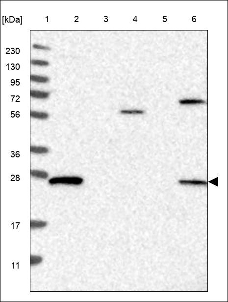 Lane 1: Marker [kDa] 230,130,95,72,56,36,28,17,11 Lane 2: RT4 Lane 3: U-251 MG Lane 4: Human Plasma Lane 5: Liver Lane 6: Tonsil