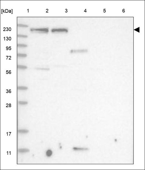 Lane 1: Marker [kDa] 230,130,95,72,56,36,28,17,11 Lane 2: RT4 Lane 3: U-251 MG Lane 4: Human Plasma Lane 5: Liver Lane 6: Tonsil