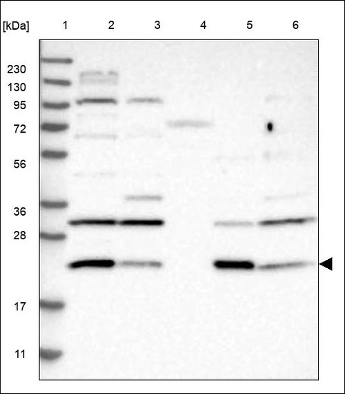 Lane 1: Marker [kDa] 230,130,95,72,56,36,28,17,11 Lane 2: RT4 Lane 3: U-251 MG Lane 4: Human Plasma Lane 5: Liver Lane 6: Tonsil