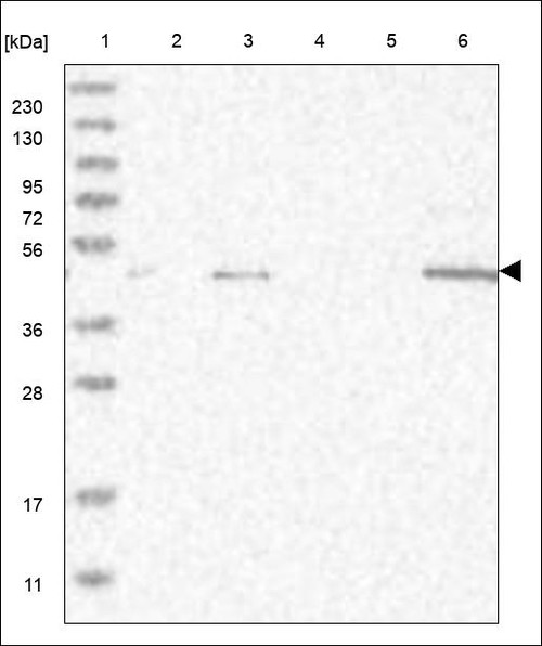 Lane 1: Marker [kDa] 230,130,95,72,56,36,28,17,11 Lane 2: RT4 Lane 3: U-251 MG Lane 4: Human Plasma Lane 5: Liver Lane 6: Tonsil