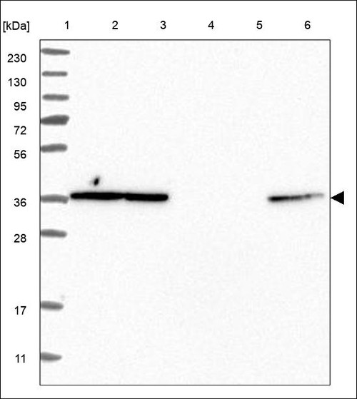 Lane 1: Marker [kDa] 230,130,95,72,56,36,28,17,11 Lane 2: RT4 Lane 3: U-251 MG Lane 4: Human Plasma Lane 5: Liver Lane 6: Tonsil