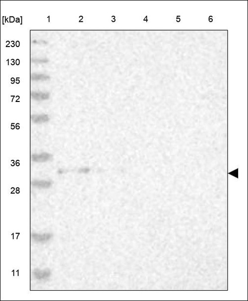 Lane 1: Marker [kDa] 230,130,95,72,56,36,28,17,11 Lane 2: RT4 Lane 3: U-251 MG Lane 4: Human Plasma Lane 5: Liver Lane 6: Tonsil