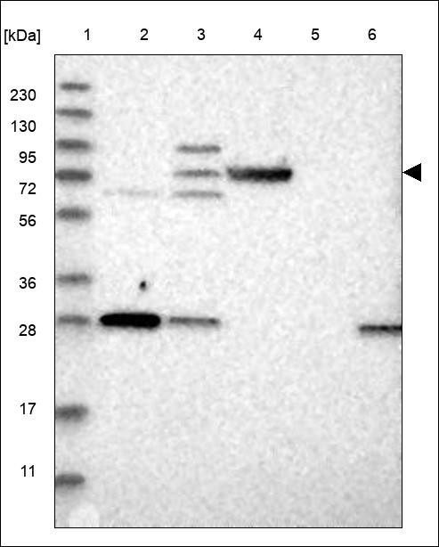 Lane 1: Marker [kDa] 230,130,95,72,56,36,28,17,11 Lane 2: RT4 Lane 3: U-251 MG Lane 4: Human Plasma Lane 5: Liver Lane 6: Tonsil