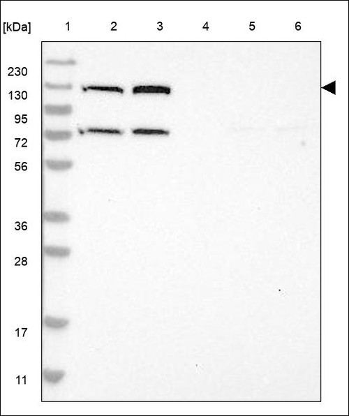 Lane 1: Marker [kDa] 230,130,95,72,56,36,28,17,11 Lane 2: RT4 Lane 3: U-251 MG Lane 4: Human Plasma Lane 5: Liver Lane 6: Tonsil