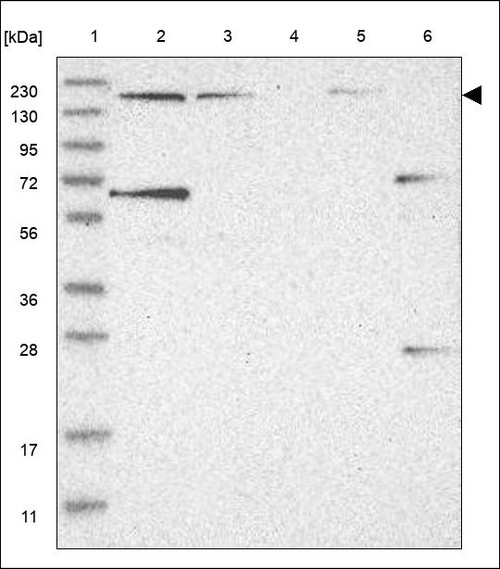 Lane 1: Marker [kDa] 230,130,95,72,56,36,28,17,11 Lane 2: RT4 Lane 3: U-251 MG Lane 4: Human Plasma Lane 5: Liver Lane 6: Tonsil