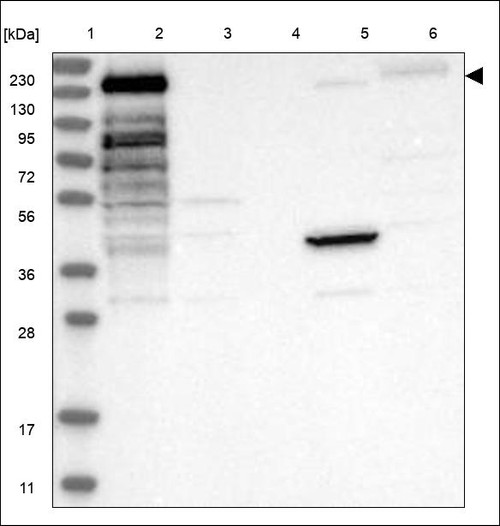 Lane 1: Marker [kDa] 230,130,95,72,56,36,28,17,11 Lane 2: RT4 Lane 3: U-251 MG Lane 4: Human Plasma Lane 5: Liver Lane 6: Tonsil