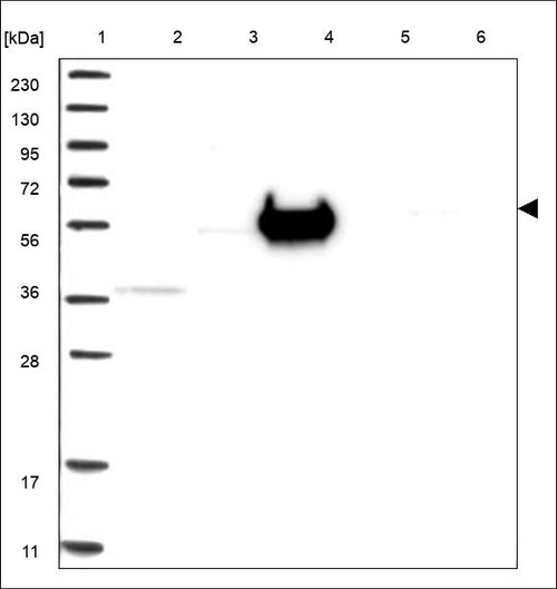 Lane 1: Marker [kDa] 230,130,95,72,56,36,28,17,11 Lane 2: RT4 Lane 3: U-251 MG Lane 4: Human Plasma Lane 5: Liver Lane 6: Tonsil