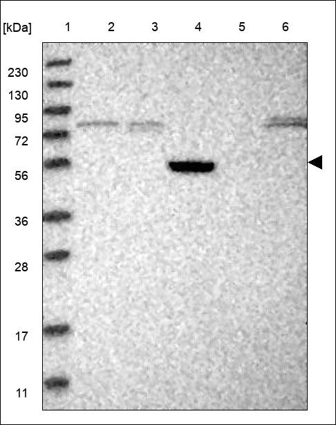 Lane 1: Marker [kDa] 230,130,95,72,56,36,28,17,11 Lane 2: RT4 Lane 3: U-251 MG Lane 4: Human Plasma Lane 5: Liver Lane 6: Tonsil