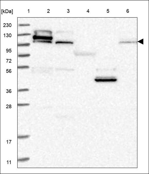 Lane 1: Marker [kDa] 230,130,95,72,56,36,28,17,11 Lane 2: RT4 Lane 3: U-251 MG Lane 4: Human Plasma Lane 5: Liver Lane 6: Tonsil
