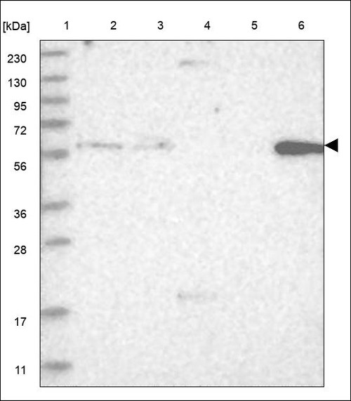 Lane 1: Marker [kDa] 230,130,95,72,56,36,28,17,11 Lane 2: RT4 Lane 3: U-251 MG Lane 4: Human Plasma Lane 5: Liver Lane 6: Tonsil