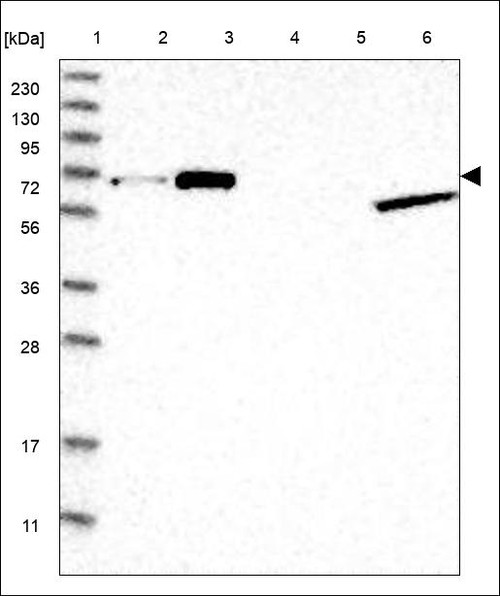 Lane 1: Marker [kDa] 230,130,95,72,56,36,28,17,11 Lane 2: RT4 Lane 3: U-251 MG Lane 4: Human Plasma Lane 5: Liver Lane 6: Tonsil