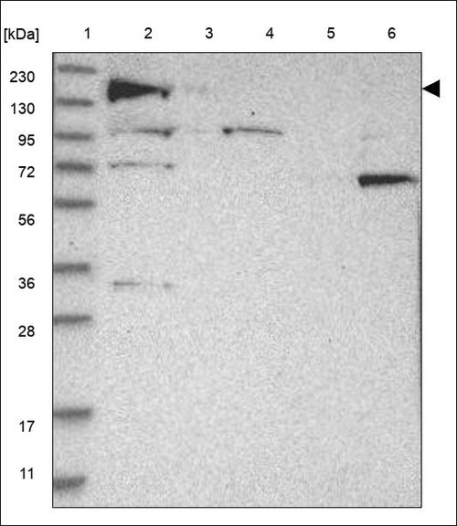 Lane 1: Marker [kDa] 230,130,95,72,56,36,28,17,11 Lane 2: RT4 Lane 3: U-251 MG Lane 4: Human Plasma Lane 5: Liver Lane 6: Tonsil