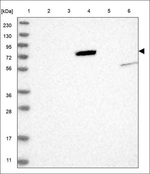 Lane 1: Marker [kDa] 230,130,95,72,56,36,28,17,11 Lane 2: RT4 Lane 3: U-251 MG Lane 4: Human Plasma Lane 5: Liver Lane 6: Tonsil