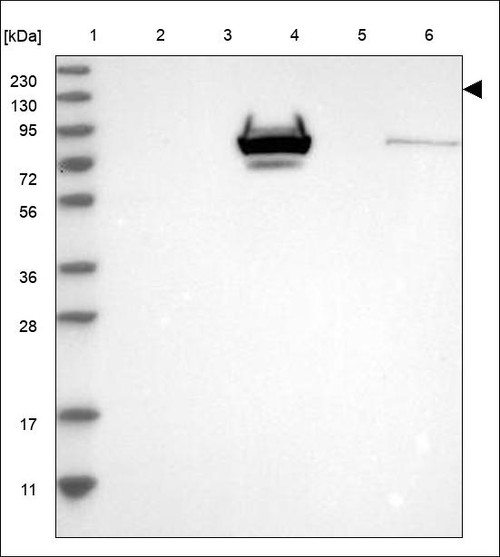 Lane 1: Marker [kDa] 230,130,95,72,56,36,28,17,11 Lane 2: RT4 Lane 3: U-251 MG Lane 4: Human Plasma Lane 5: Liver Lane 6: Tonsil