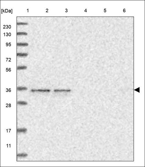 Lane 1: Marker [kDa] 230,130,95,72,56,36,28,17,11 Lane 2: RT4 Lane 3: U-251 MG Lane 4: Human Plasma Lane 5: Liver Lane 6: Tonsil