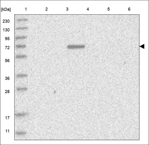 Lane 1: Marker [kDa] 230,130,95,72,56,36,28,17,11 Lane 2: RT4 Lane 3: U-251 MG Lane 4: Human Plasma Lane 5: Liver Lane 6: Tonsil