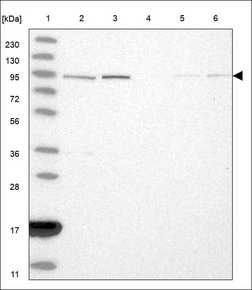 Lane 1: Marker [kDa] 230,130,95,72,56,36,28,17,11 Lane 2: RT4 Lane 3: U-251 MG Lane 4: Human Plasma Lane 5: Liver Lane 6: Tonsil