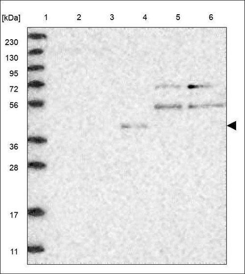 Lane 1: Marker [kDa] 230,130,95,72,56,36,28,17,11 Lane 2: RT4 Lane 3: U-251 MG Lane 4: Human Plasma Lane 5: Liver Lane 6: Tonsil