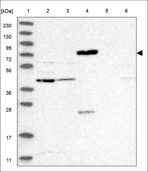 Lane 1: Marker [kDa] 230,130,95,72,56,36,28,17,11 Lane 2: RT4 Lane 3: U-251 MG Lane 4: Human Plasma Lane 5: Liver Lane 6: Tonsil
