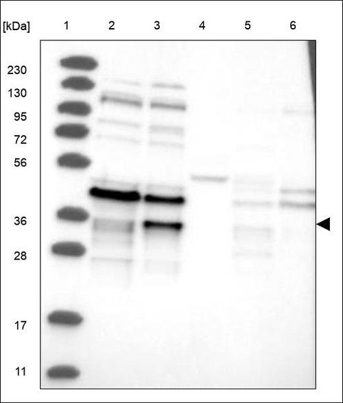 Lane 1: Marker [kDa] 230,130,95,72,56,36,28,17,11 Lane 2: RT4 Lane 3: U-251 MG Lane 4: Human Plasma Lane 5: Liver Lane 6: Tonsil