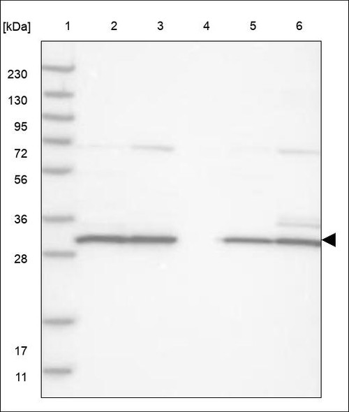 Lane 1: Marker [kDa] 230,130,95,72,56,36,28,17,11 Lane 2: RT4 Lane 3: U-251 MG Lane 4: Human Plasma Lane 5: Liver Lane 6: Tonsil