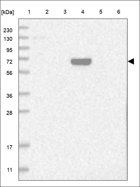 Lane 1: Marker [kDa] 230,130,95,72,56,36,28,17,11 Lane 2: RT4 Lane 3: U-251 MG Lane 4: Human Plasma Lane 5: Liver Lane 6: Tonsil