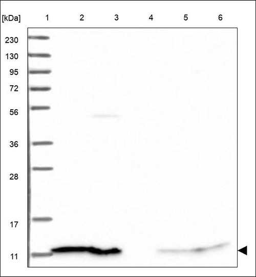 Lane 1: Marker [kDa] 230,130,95,72,56,36,28,17,11 Lane 2: RT4 Lane 3: U-251 MG Lane 4: Human Plasma Lane 5: Liver Lane 6: Tonsil