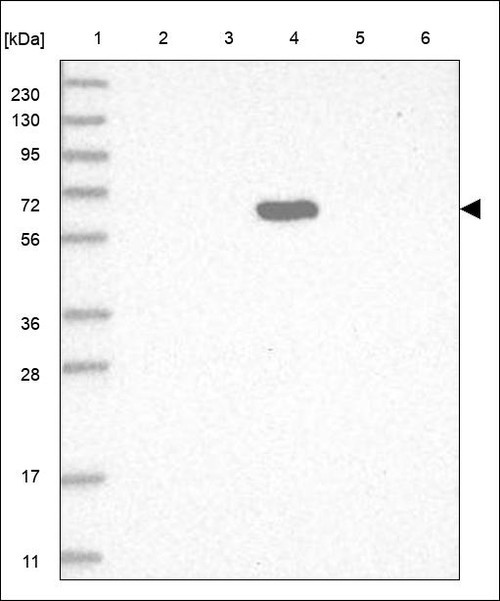 Lane 1: Marker [kDa] 230,130,95,72,56,36,28,17,11 Lane 2: RT4 Lane 3: U-251 MG Lane 4: Human Plasma Lane 5: Liver Lane 6: Tonsil