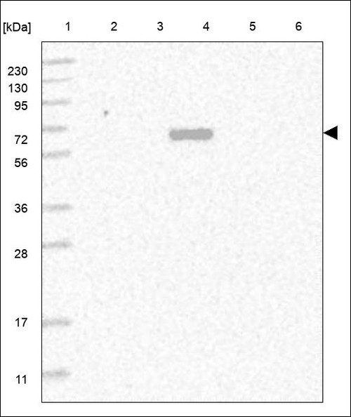 Lane 1: Marker [kDa] 230,130,95,72,56,36,28,17,11 Lane 2: RT4 Lane 3: U-251 MG Lane 4: Human Plasma Lane 5: Liver Lane 6: Tonsil