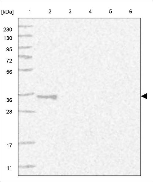 Lane 1: Marker [kDa] 230,130,95,72,56,36,28,17,11 Lane 2: RT4 Lane 3: U-251 MG Lane 4: Human Plasma Lane 5: Liver Lane 6: Tonsil
