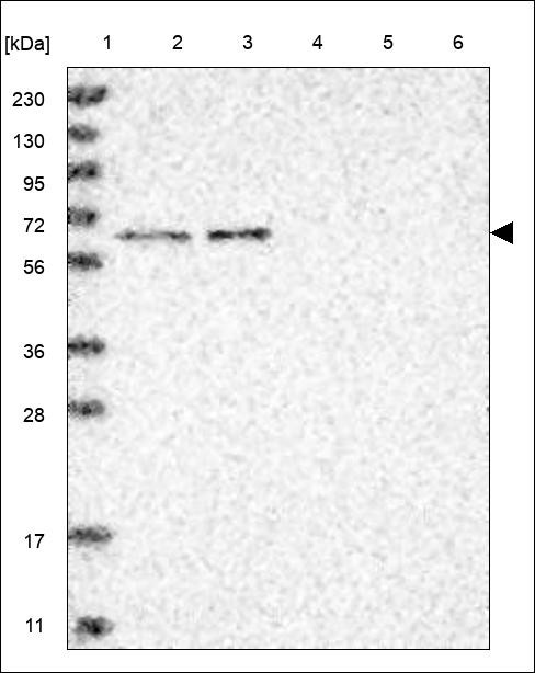 Lane 1: Marker [kDa] 230,130,95,72,56,36,28,17,11 Lane 2: RT4 Lane 3: U-251 MG Lane 4: Human Plasma Lane 5: Liver Lane 6: Tonsil