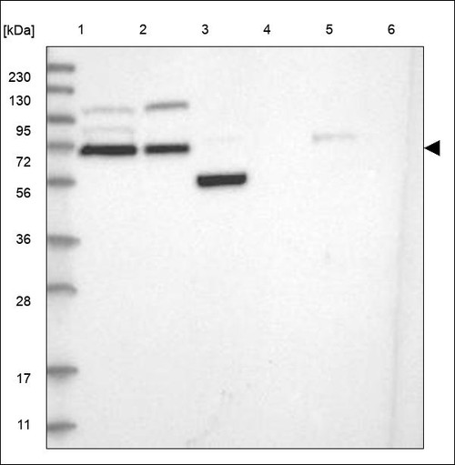 Lane 1: Marker [kDa] 230,130,95,72,56,36,28,17,11 Lane 2: RT4 Lane 3: U-251 MG Lane 4: Human Plasma Lane 5: Liver Lane 6: Tonsil
