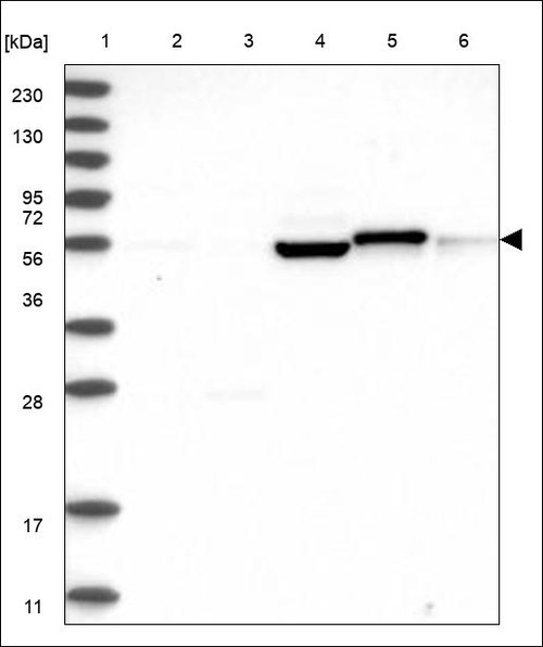 Lane 1: Marker [kDa] 230,130,95,72,56,36,28,17,11 Lane 2: RT4 Lane 3: U-251 MG Lane 4: Human Plasma Lane 5: Liver Lane 6: Tonsil
