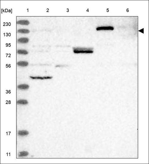 Lane 1: Marker [kDa] 230,130,95,72,56,36,28,17,11 Lane 2: RT4 Lane 3: U-251 MG Lane 4: Human Plasma Lane 5: Liver Lane 6: Tonsil