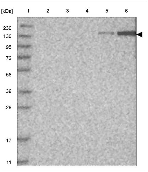 Lane 1: Marker [kDa] 230,130,95,72,56,36,28,17,11 Lane 2: RT4 Lane 3: U-251 MG Lane 4: Human Plasma Lane 5: Liver Lane 6: Tonsil