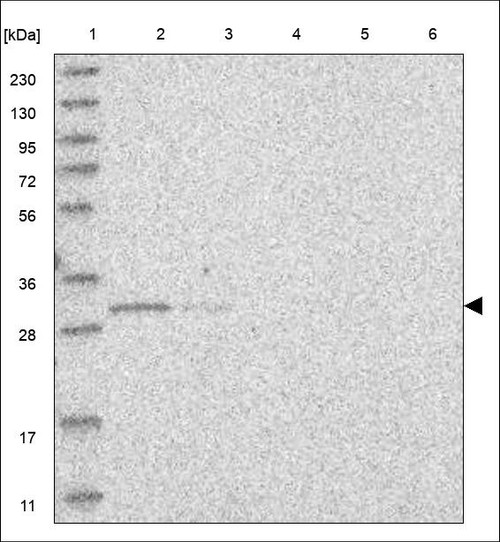 Lane 1: Marker [kDa] 230,130,95,72,56,36,28,17,11 Lane 2: RT4 Lane 3: U-251 MG Lane 4: Human Plasma Lane 5: Liver Lane 6: Tonsil