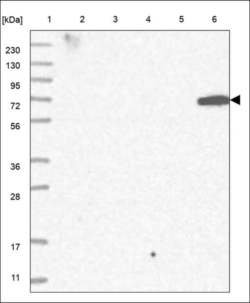Lane 1: Marker [kDa] 230,130,95,72,56,36,28,17,11 Lane 2: RT4 Lane 3: U-251 MG Lane 4: Human Plasma Lane 5: Liver Lane 6: Tonsil