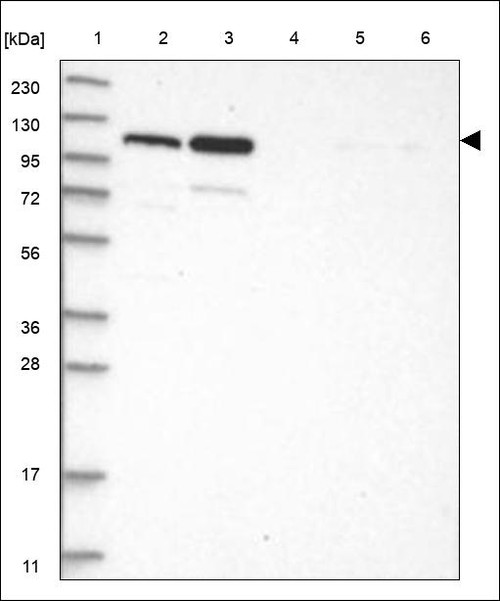 Lane 1: Marker [kDa] 230,130,95,72,56,36,28,17,11 Lane 2: RT4 Lane 3: U-251 MG Lane 4: Human Plasma Lane 5: Liver Lane 6: Tonsil
