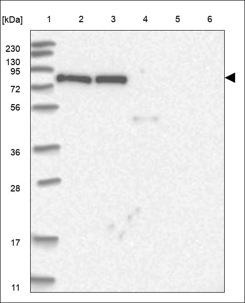 Lane 1: Marker [kDa] 230,130,95,72,56,36,28,17,11 Lane 2: RT4 Lane 3: U-251 MG Lane 4: Human Plasma Lane 5: Liver Lane 6: Tonsil