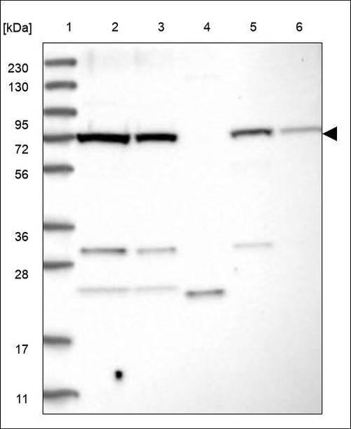 Lane 1: Marker [kDa] 230,130,95,72,56,36,28,17,11 Lane 2: RT4 Lane 3: U-251 MG Lane 4: Human Plasma Lane 5: Liver Lane 6: Tonsil