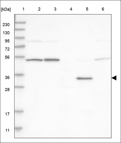 Lane 1: Marker [kDa] 230,130,95,72,56,36,28,17,11 Lane 2: RT4 Lane 3: U-251 MG Lane 4: Human Plasma Lane 5: Liver Lane 6: Tonsil
