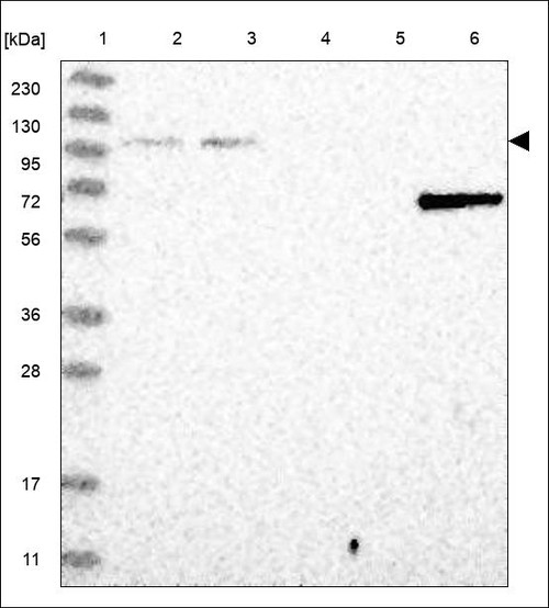 Lane 1: Marker [kDa] 230,130,95,72,56,36,28,17,11 Lane 2: RT4 Lane 3: U-251 MG Lane 4: Human Plasma Lane 5: Liver Lane 6: Tonsil