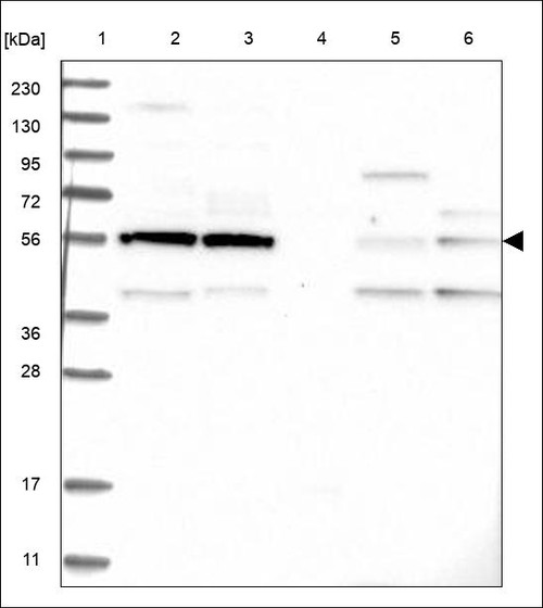 Lane 1: Marker [kDa] 230,130,95,72,56,36,28,17,11 Lane 2: RT4 Lane 3: U-251 MG Lane 4: Human Plasma Lane 5: Liver Lane 6: Tonsil