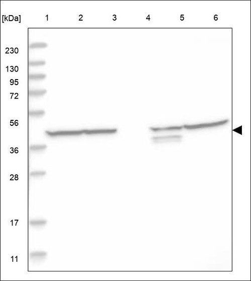 Lane 1: Marker [kDa] 230,130,95,72,56,36,28,17,11 Lane 2: RT4 Lane 3: U-251 MG Lane 4: Human Plasma Lane 5: Liver Lane 6: Tonsil