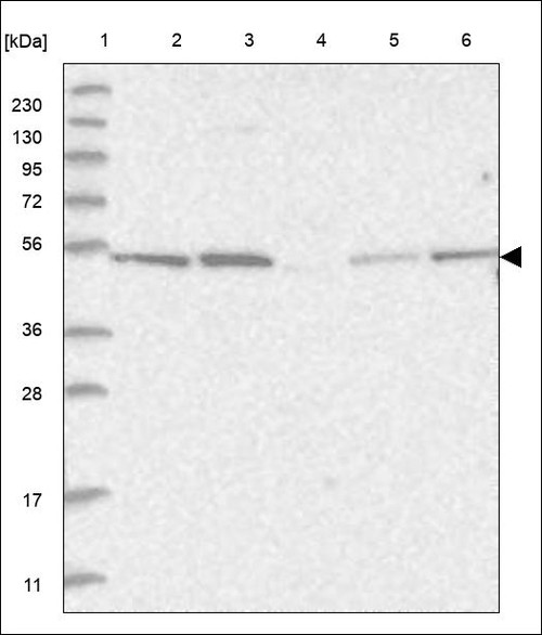Lane 1: Marker [kDa] 230,130,95,72,56,36,28,17,11 Lane 2: RT4 Lane 3: U-251 MG Lane 4: Human Plasma Lane 5: Liver Lane 6: Tonsil