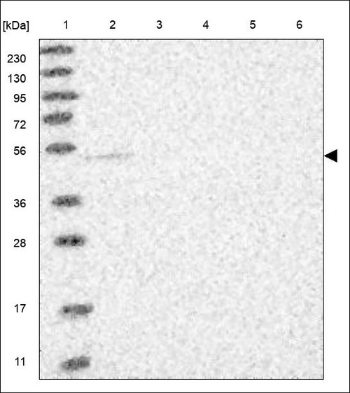 Lane 1: Marker [kDa] 230,130,95,72,56,36,28,17,11 Lane 2: RT4 Lane 3: U-251 MG Lane 4: Human Plasma Lane 5: Liver Lane 6: Tonsil