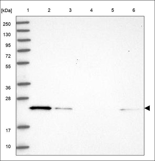 Lane 1: Marker [kDa] 250,130,95,72,55,36,28,17,10 Lane 2: RT4 Lane 3: U-251 MG Lane 4: Human Plasma Lane 5: Liver Lane 6: Tonsil