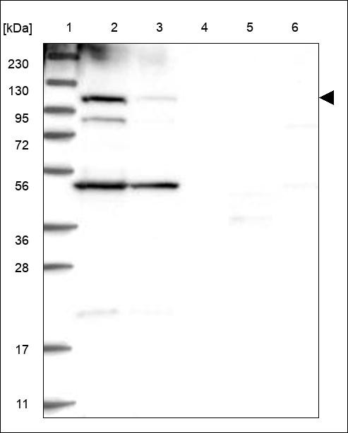 Lane 1: Marker [kDa] 230,130,95,72,56,36,28,17,11 Lane 2: RT4 Lane 3: U-251 MG Lane 4: Human Plasma Lane 5: Liver Lane 6: Tonsil