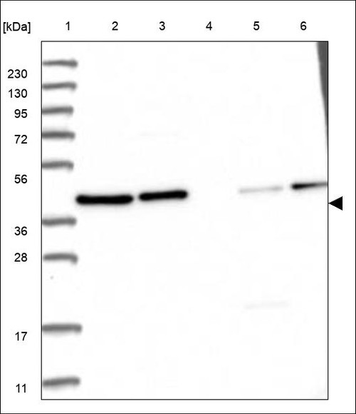 Lane 1: Marker [kDa] 230,130,95,72,56,36,28,17,11 Lane 2: RT4 Lane 3: U-251 MG Lane 4: Human Plasma Lane 5: Liver Lane 6: Tonsil